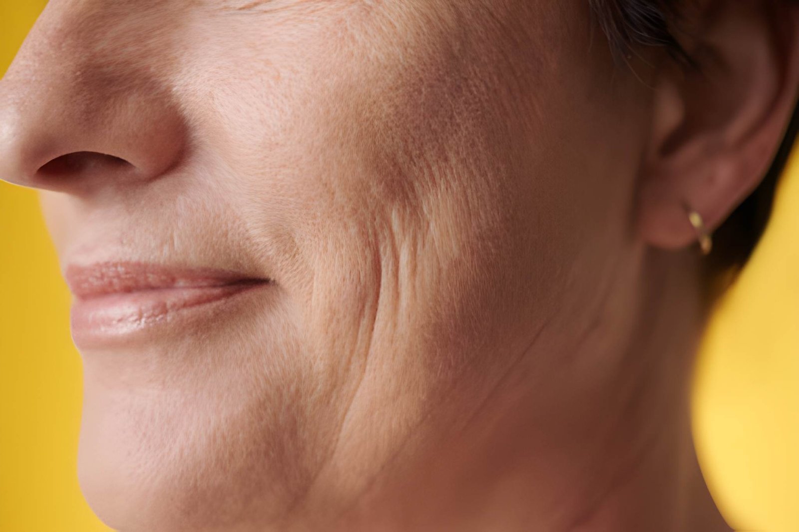 Early Signs of Aging: How to Prevent Fine Lines and Wrinkles
