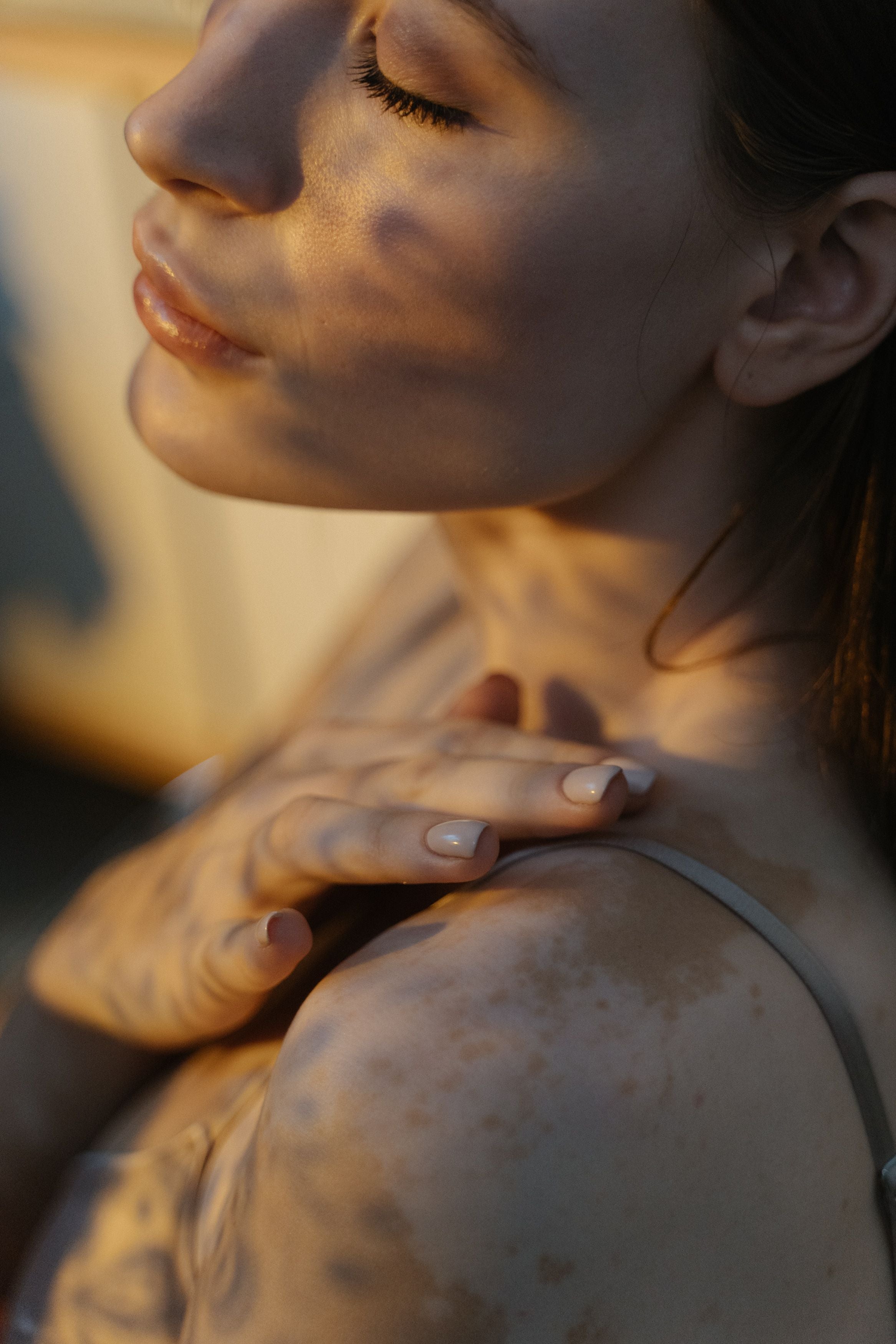 Hyperpigmentation