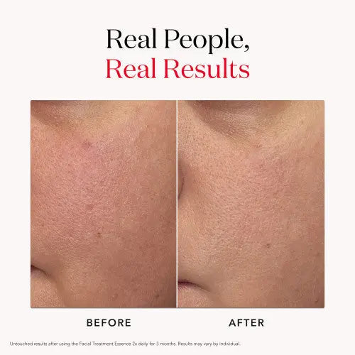 PITERA™ Facial Treatment Essence - Hydrating Skin Essence | SK-II US SK-II Skinarchives