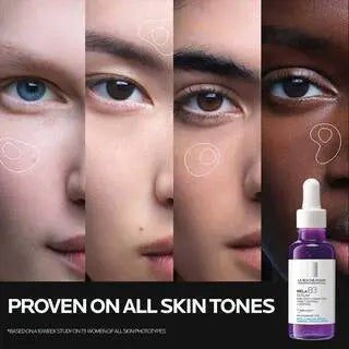 Mela B3 Dark Spot Serum With Melasyl™ + Niacinamide | La Roche-Posay La Roche-Posay hyperpigmentation treatment Skinarchives