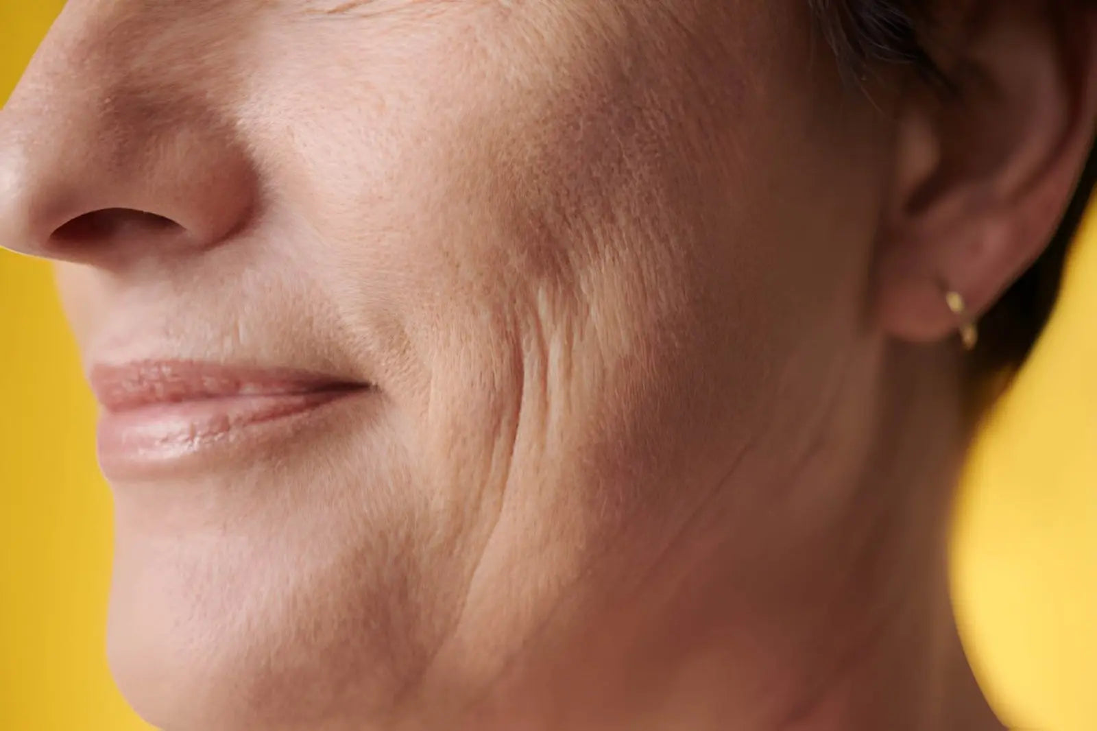 Early Signs of Aging: How to Prevent Fine Lines and Wrinkles Skinarchives